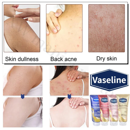 Vaseline Glutamine Whitening Body Lotion Highly Concentrated Niacinamide Hyaluronic Acid Brightens Skin Deeply Hydrating 330ml