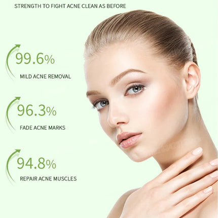 Anti-Acne Cream Effectively Removes Skin Nodules Pustules Cysts Papules Blackheads Men And Women Acne Skin Care Essence Cream