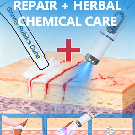 Striae Laser Device Eliminate Body Stretch Marks Products