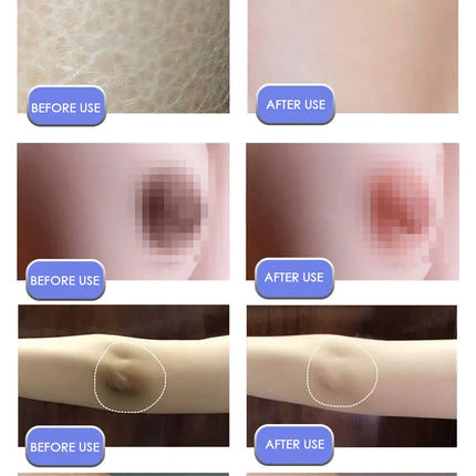 Body Whitening Cream Private Parts Underarm Bleaching Serum Whiten Butt Knee Brighten Inner Thigh Intimate Dark Remove Melanin