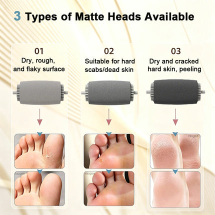 Electric Feet Callus Removers Portable Electronic Foot File Rechargeable Callus Remover for Dead Hard Cracked Dry Skin Feet Care