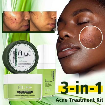 AILKE Acne Removal Face Care Set, Effectively Anti Acne-Prone Skin, Pimples, Control Breakouts, Unclog Pores, For Women and Men