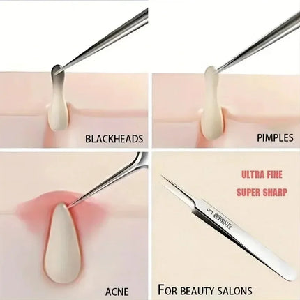 New 1/3 Pack Extra Fine No. 5 Cellular Acne Blackhead Tweezers - Facial Beauty Remove Acne Needle Tools for Skin Care Tools