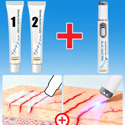 Striae Laser Device Eliminate Body Stretch Marks Products
