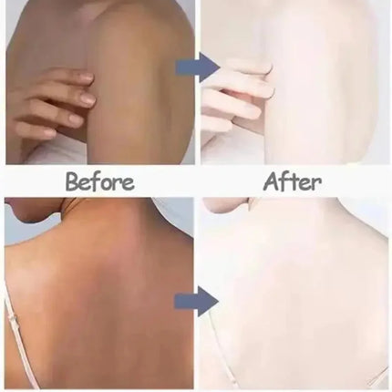 Body Whitening Cream Private Parts Underarm Knee Thigh Inner Melanin Bleaching Brighten Lotion Dark Skin Healthy White Body Care
