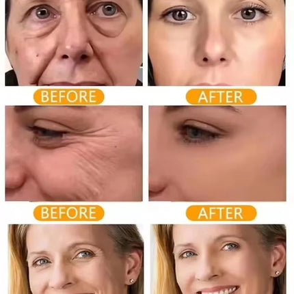 Instant Collagen Protein Threads Lifting Firming Absorbable Face Filler Anti-aging Deep Repair Fade Fine Lines Korean Skincare