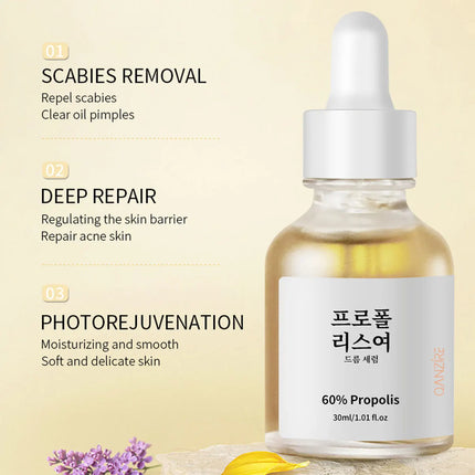 Propolis And Salicylic Acid Acne Treatment Essence, Pore Refining Essence, Glutathione And Niacinamide For Brighter Skin