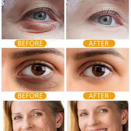 Instant Eye Bag Removal Cream Collagen Anti-Wrinkle Fade Fine Lines Firming Skin Anti Dark Circle Puffiness Brighten Eye Care