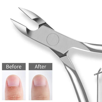 2in1 Nail Cuticle Nipper Stainless Steel Precision Dead Skin Remover Manicure Scissors for Salon and Personal Care