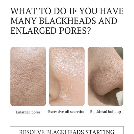 Unisex Blackhead Remove Mask Bamboo Charcoal Shrinking Pore Nose Deep Cleaning Mask Improve Rough Skin Acne Treatment Skin Care