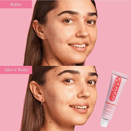 2025high-end Fade, whiten and clear essence | reduce spots and spots