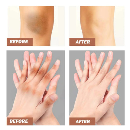 Dark Knuckles Fast Brighten Cream Elbows Hand Knuckle Brightening Serum Knee Black Skin Quickly Lighten Stains Remover Products