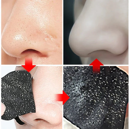 100-10pcs Bamboo Charcoal Tearing Nasal Mask Paste Can Quickly Remove Blackheads and Comedones and Restore A Refreshing Nose