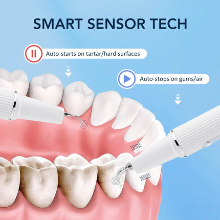 Electric Teeth Cleaner Dental Scaler Plaque Tartar Calculus Stain Remover Oral Care Rechargeable Home Use Teeth Whitening Kit
