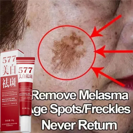 Niacinamide Whitening Spot Removal Cream Dark Spot Corrector Face Cream Melasma Freckle Sun Spot Remover Brighten Anti-Aging 30g