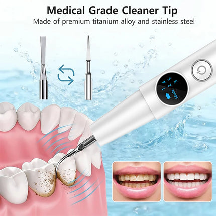 Dental Calculus Remover Ultrasonic Tooth Cleaner Tartar Eliminator Dental Ultrasound Plaque Stains Removal Teeth Whitening