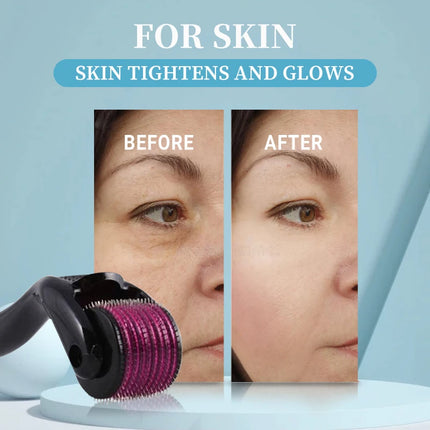 Micro Needling 540 Roller Derma Roller Professional Titanium Dermaroller 0.2/0.25/0.3mm Hair Regrowth Beard Growth Treatment