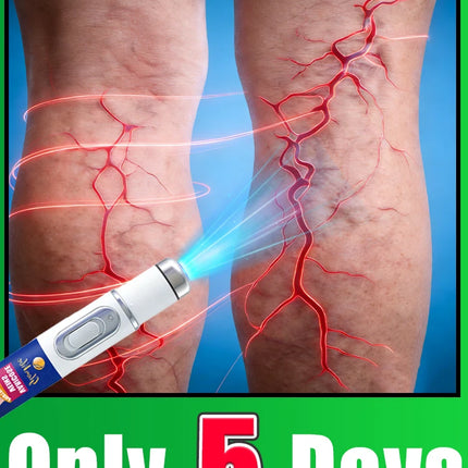 2026 New upgraded laser, remove spider legs and varicose veins in just 5 days