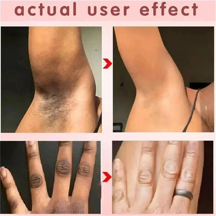 Body Whitening Cream Arms Thighs Underarm Knees Whitening Essence Cream Brighten Moisturizing Body Korean Skin Care Products