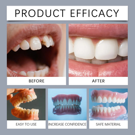 New Denture Silicone Kit - Soft Kit Teeth Upper And Lower Set - Silicone Liners Soft Denture Kit - Easy Use