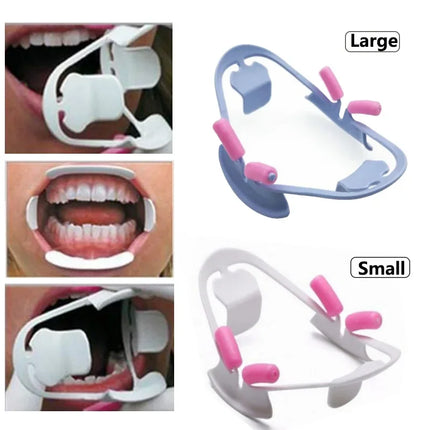 30pcs 3D Dental Mouth Opener Lip Retractor Orthodontic Dental Instrument Professional Dentist Tools for Dentistry Materials
