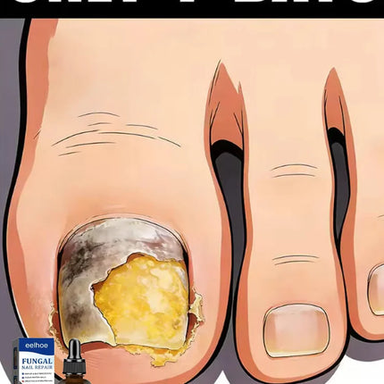 YTS Rejuvenator - Fungus Prevention Technology - Adjustable Temperature Control & Safety Sensor