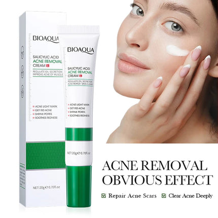 Salicylic Acid Face Cream Acne Creams Mark Repair Firming Moisturizing Blackhead Remover skincare Facial Cream