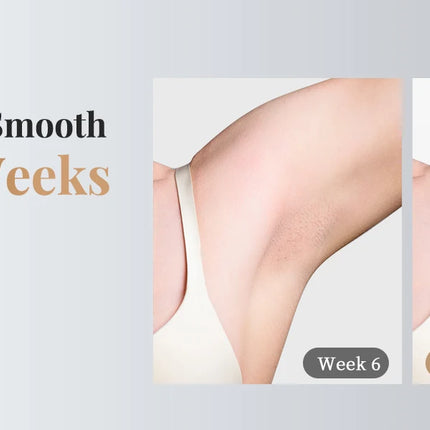 Laser Hair Removal Pro IPL Devices Painless Permanent Epilator with HR/SC/RA, 9 Energy Levels 999999+ Light Body Hair Trimmer