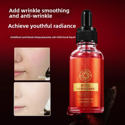 30ml Umbilical Cord Blood Sheep Placenta Cell Serum Moisturizing and Delicate Skin Serum, the skin is more tender than peers