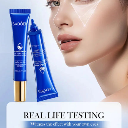 Caviar Eye Bag Removal Cream Hyaluronic Acid Anti-Wrinkle Firming Skin Fade Fine Lines Anti Dark Circle Puffiness Eye Care 20g