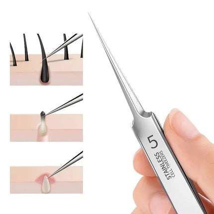 New 1/3 Pack Extra Fine No. 5 Cellular Acne Blackhead Tweezers - Facial Beauty Remove Acne Needle Tools for Skin Care Tools