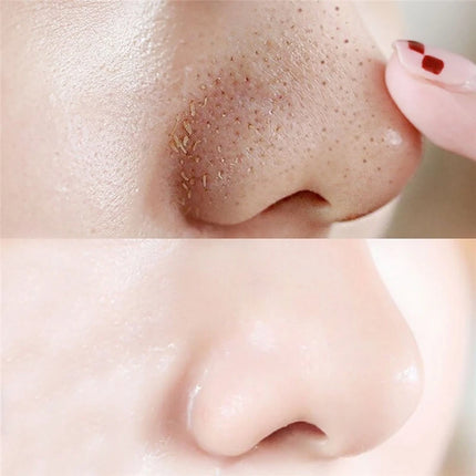 10/30/50pcs Unisex Blackhead Remove Mask Peel Nasal Strips Deep Cleansing Shrink Pore Nose Black Head Stickers Skin Care Patch