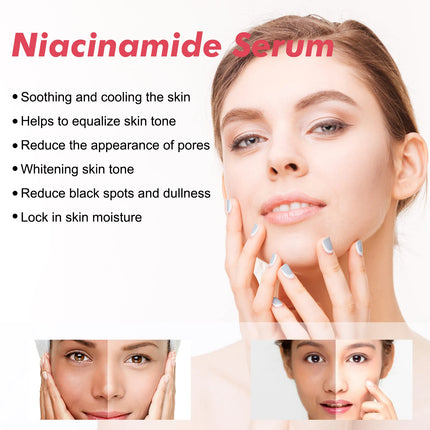Peach 70% Niacinamide Facial Serum Fade Melanin Moisturzing Shrink Pores Smooth Brightening Skin Care Dark Spot Remover Serum