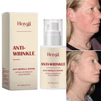Only 1 - 30ml
