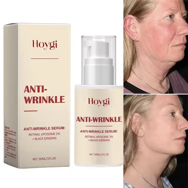Seoul 1988 2% Retinal Anti-Aging Wrinkle Serum Ginseng Facial Essence Firming Pores Brightening Face Moisturizer Korean Skincare