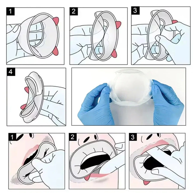 5 Pcs Dental Mouth Opener 3D Lip Cheek Retractor O Shape Rubber Expander for Oral Examination and Treatment