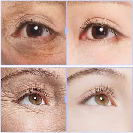 Instant Eye Cream For Anti Aging Dark Circles Bags Puffiness Great Under Eye Skin Face Tightening Eye Lift Treatment Care A