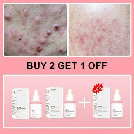 Salmon PDRN Collagen Peptide Facial Serum for Dull Skin - Boosts Elasticity Skin Renewal Repair Korean Beauty Product