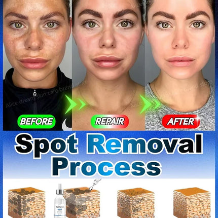 2025 Bestselling Facial Spot-Fading Cream, Effectively Removes Facial Dark Spots