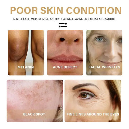 Ectoine Face Serum  Moisturizing Firming Lifting Hyaluronic Acid Collagen Anti-wrinkles Whitening Anti AgingSkin Care Essence