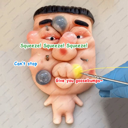 Funny Pimple Popper Squishy Toy Fast Rebound Squeeze Face Model Stress Relief Fidget Toys for Adults & Kids Funny Gag Prank Gift