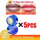 5 pcs