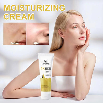Kojic Acid Face Cream Lotion Glutathione Vitamin C Deep Hydrating Nourishing Moisturizer Evens Out Skin Tone For Day & Night Use