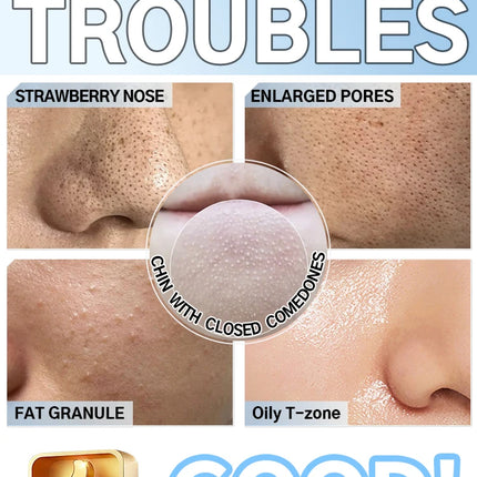 Blackhead Remover pimples and blackheads vacuum pores removal  facial skin cleansing device For Deep cleaning home