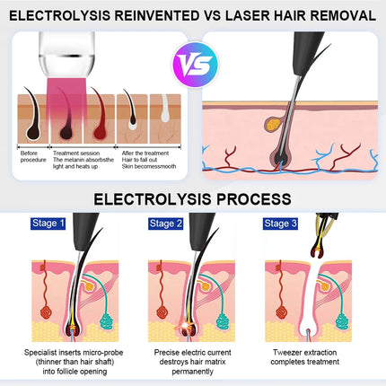 2025 Portable 5 in 1 Electric Needle Hair Removal Insulated Electric Needle Painless Electrolysis Needle Hair Removal Device