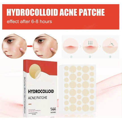 144pcs Invisible Removal Pimple Anti-Acne Hydrocolloid Patches Spots Marks Concealer Repair Sticker Waterproof Beauty-health