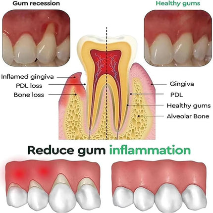 Quick Gum Repair Gel Effectively Relieve Tooth Allergy Cavities Tooth Cleaning Toothpaste Relieve Tooth Damage Serum