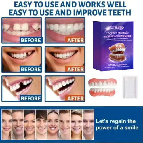 Flexible Silicone Dentures Full Set – Realistic Upper & Lower False Teeth, Comfort Fit, Secure Hold, Natural Smile Replacement