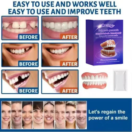 Soft Silicone Snap-On Denture Kit – Realistic Upper Lower Teeth, Instant Comfort, Strong Secure Hold, Natural Smile Replacement