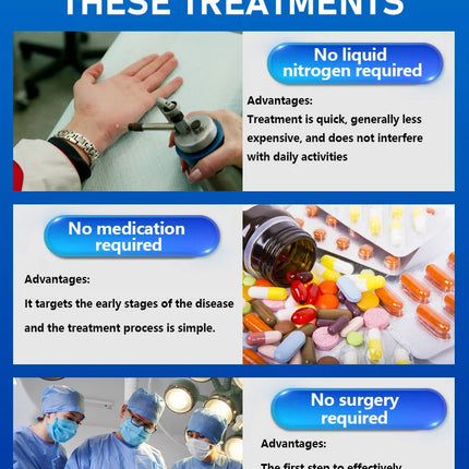 Safe and effective blue bottle, remove warts body tools wart freeze